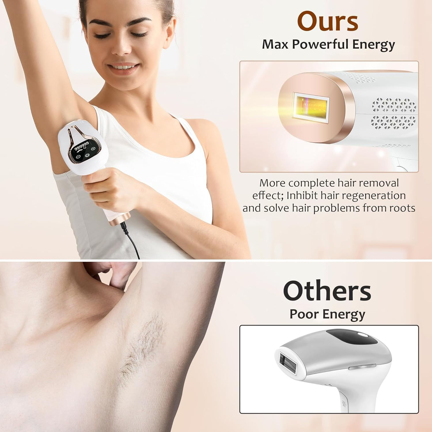 Ipl Hair Removal Laser Epilato - Opt Ipl Laser Hair Removal Machine 评论和价格