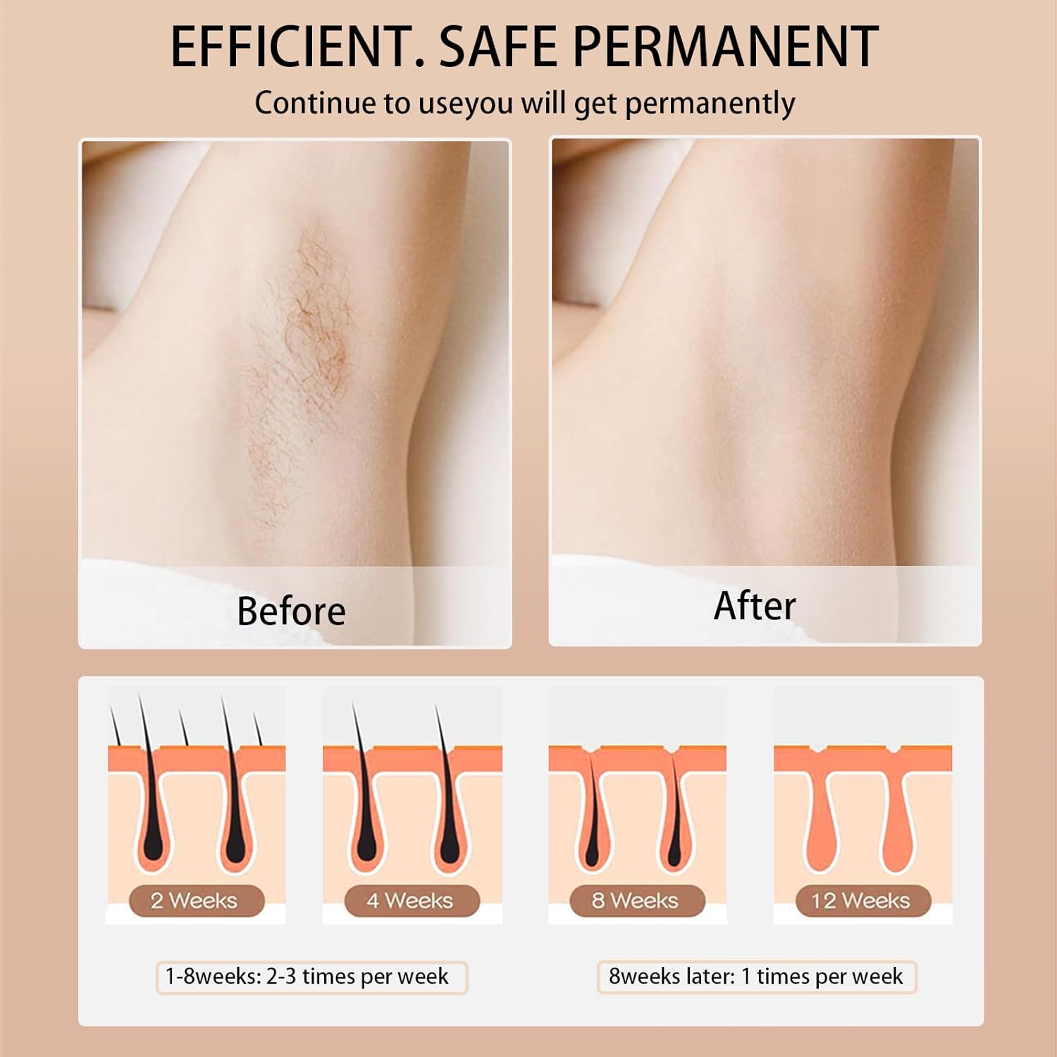 Ipl Hair Removal Laser Epilato - Opt Ipl Laser Hair Removal Machine 评论和价格
