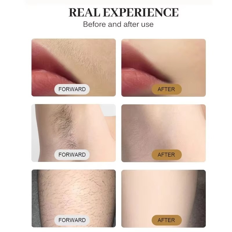 808nm Diode Laser Hair Removal - Cooling Gel For Laser Hair Removal 评论和价格