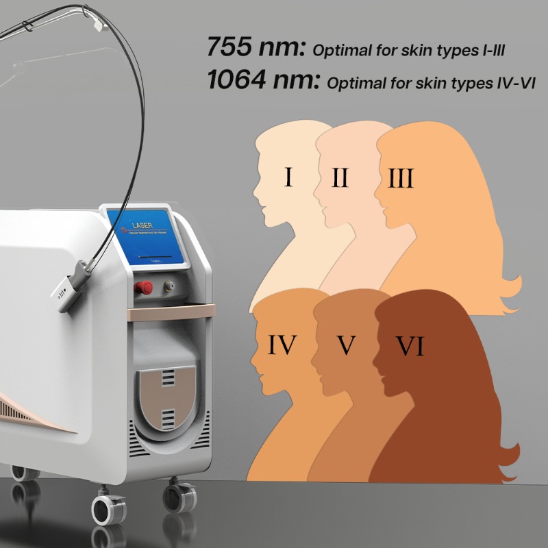 1064Nm Long Pulse Nd Yag Laser - Alexandrite Laser Hair Removal Machine 评论和价格
