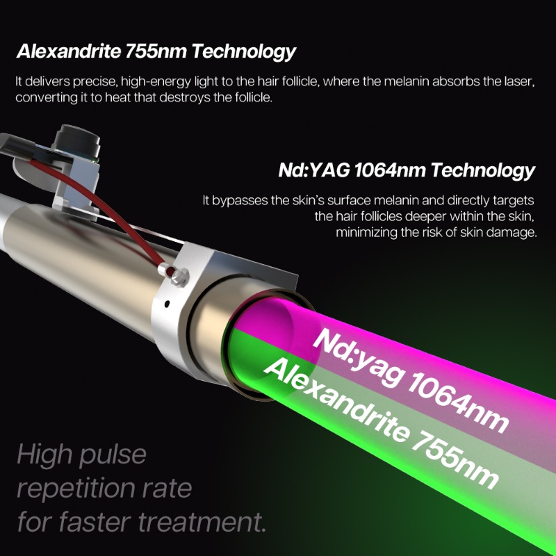 1064Nm Long Pulse Nd Yag Laser - Alexandrite Laser Hair Removal Machine 评论和价格