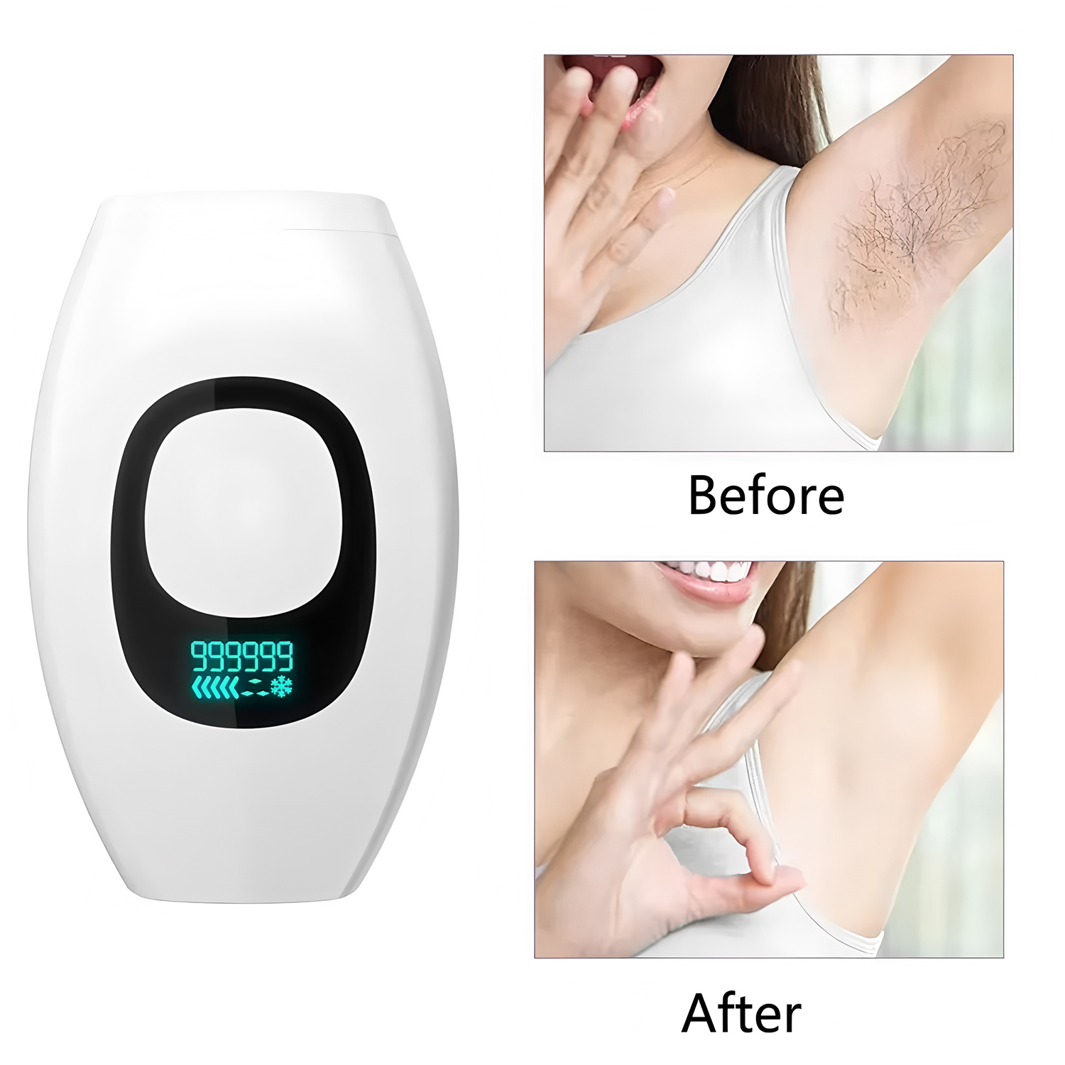 Digital Display IPL 500,000 Fl - Opt Ipl Laser Hair Removal Machine 评论和价格