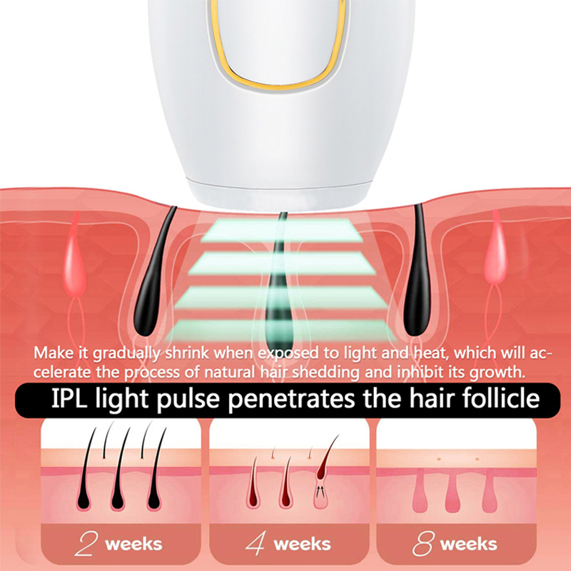 Professional Permanent Laser D - Ipl Hair Removal Handset Permanent 评论和价格