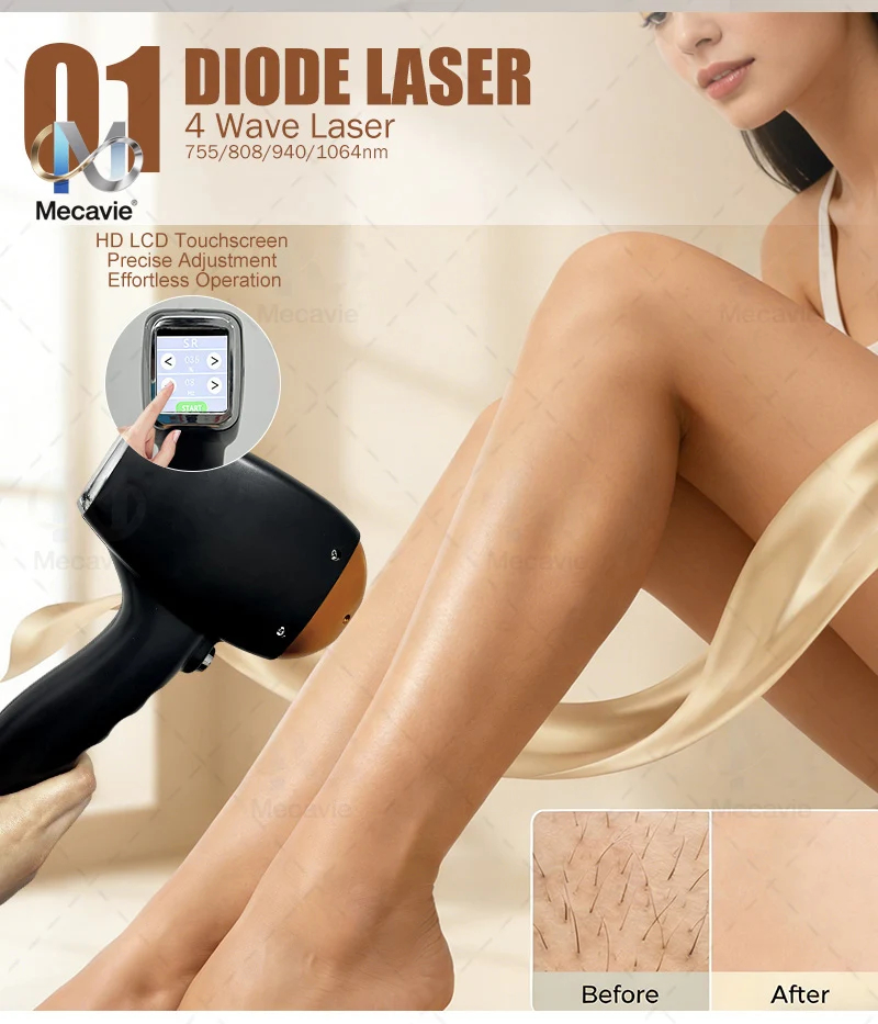 4 In 1 2026 Newest Diode Laser - Opt Ipl Laser Hair Removal Machine 评论和价格
