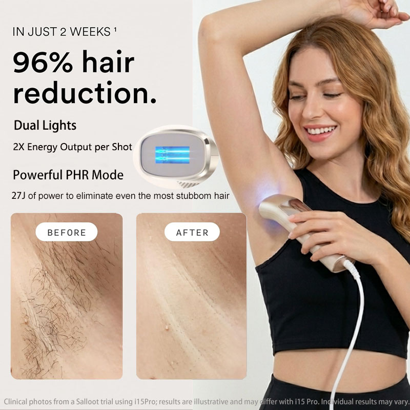 Trinity I15 Pro Sapphire Ice C - Home Ipl Hair Removal Sapphire Cooling 评论和价格