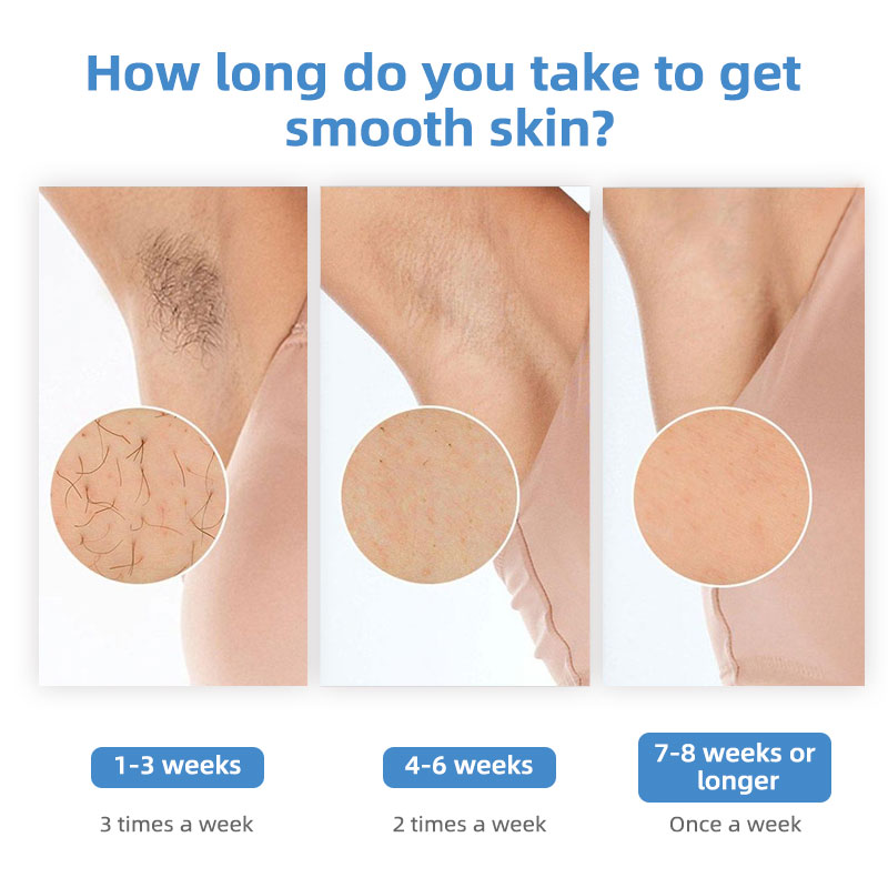 IShine Sapphire Ice Cooling IP - Home Ipl Hair Removal Sapphire Cooling 评论和价格